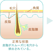 皮脂がスムーズに毛穴から排出されている