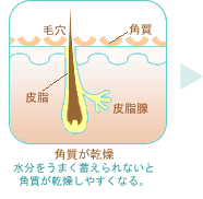 角質が乾燥・水分を上手く蓄えられないと角質が乾燥しやすくなる